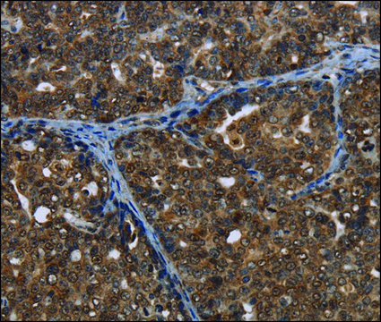 Anti-CERS6 antibody produced in rabbit