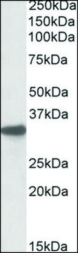 Anti-Cyb5r3 (C-terminal) antibody produced in