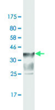 Monoclonal Anti-SLC44A2 antibody produced in