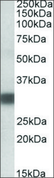 Anti-PDXP (C-terminal) antibody produced in