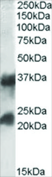 Anti-CTLA and CTLB antibody produced