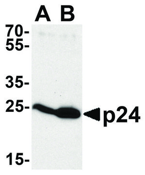 Anti-HIV-1 P24 antibody produced in