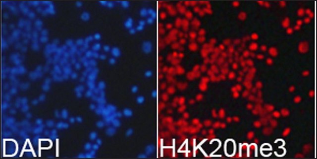 Anti-Histone H4K20me3 antibody produced in