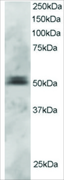 Anti-PAX5/BSAP antibody produced in goat