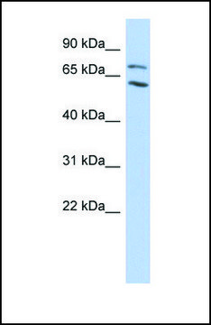 Anti-MTA2, (N-terminal) antibody produced in