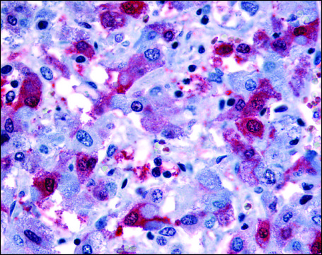Anti-PTGFR antibody produced in rabbit