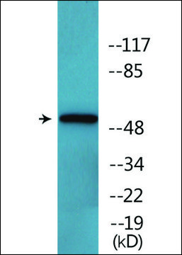 Anti-phospho-Keratin 8 (pSer?³²) antibody produced