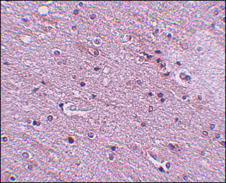 Anti-TMEM16B antibody produced in rabbit