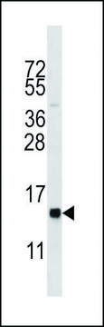 ANTI-HIST1H2BL (N-TERM) antibody produced in