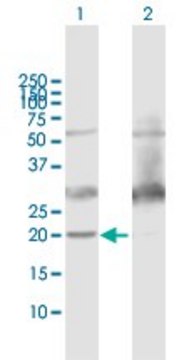 Anti-ATP5H antibody produced in mouse