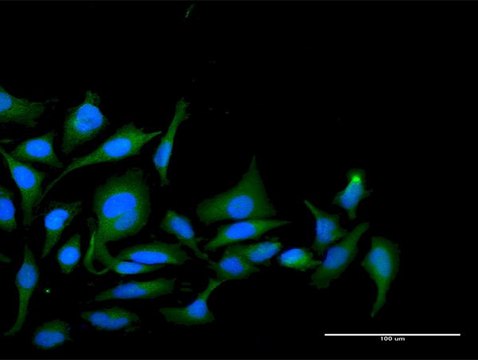 Anti-PPP1R2 antibody produced in rabbit