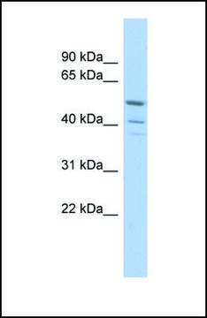 Anti-TRIM50 antibody produced in rabbit