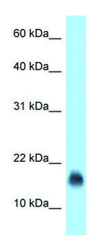 Anti-JCHAIN (N-terminal) antibody produced in