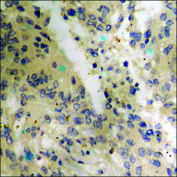 Anti-phospho-p53 (pThr¹?) antibody produced in