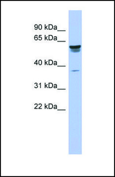 Anti-TRIM4, (N-terminal) antibody produced in