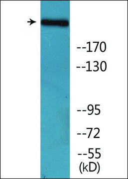 Anti-phospho-Acetyl-CoA Carboxylase (pSer??) antibody produced
