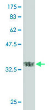 ANTI-TGIF2 antibody produced in mouse