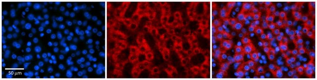 Anti-RARA antibody produced in rabbit