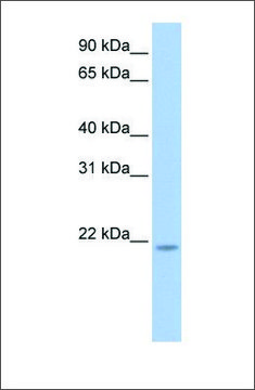 Anti-RNF5 antibody produced in rabbit