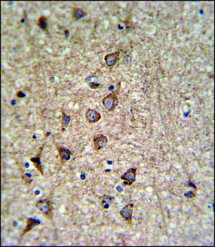 ANTI-SLC25A37 (C-TERM) antibody produced in