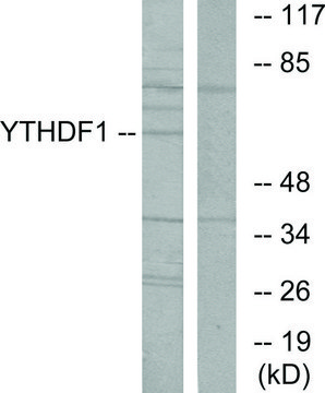 Anti-YTHDF1 antibody produced in rabbit