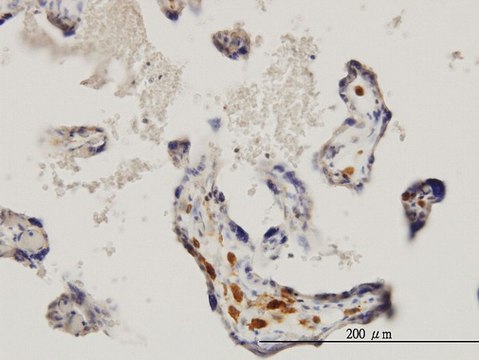 Monoclonal Anti-MKNK1 antibody produced in