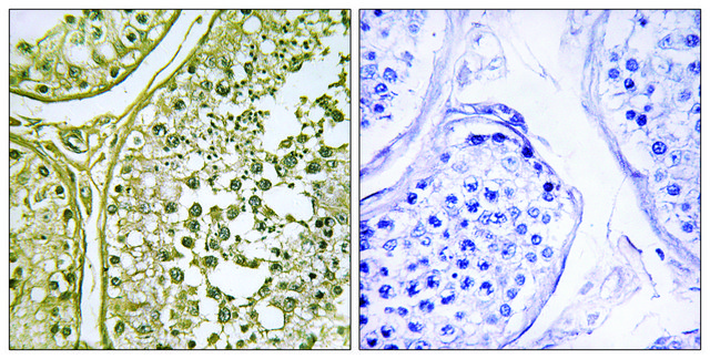 Anti-CKI-?1 antibody produced in rabbit