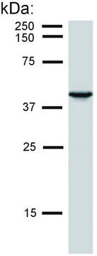 Monoclonal Anti-Cytokeratin 19 antibody produced