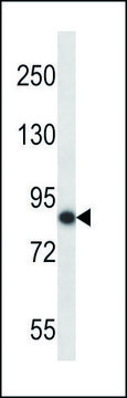 ANTI-MOUSE NEK5 (C-TERM) antibody produced