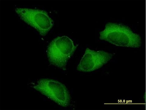 Anti-PFKP antibody produced in mouse