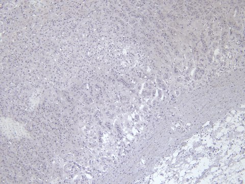 Anti-VMAT2/SLC18A2 antibody produced in goat