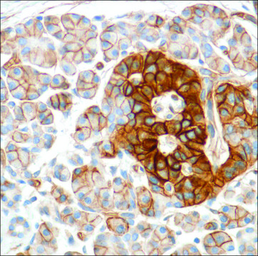 Anti-HENT1 antibody, Rabbit monoclonal