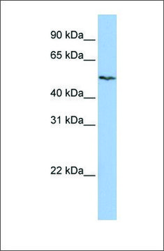 Anti-SLC16A6 antibody produced in rabbit