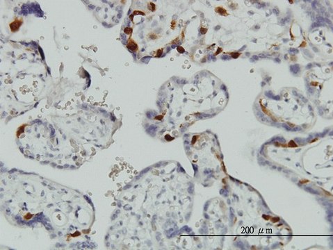 Monoclonal Anti-UBE2C antibody produced in