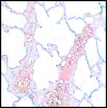 Anti-REEP2 antibody produced in rabbit