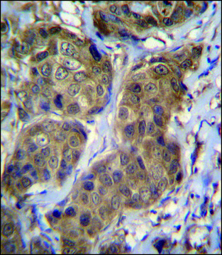 ANTI-RNF11 (CENTER) antibody produced in
