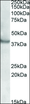 Anti-RAPSN (N-terminal) antibody produced in