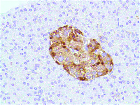 Anti-Chromogranin A antibody, Rabbit monoclonal