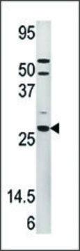 Anti-PMVK (C-term) antibody produced in