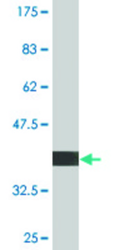 Monoclonal Anti-UBE4B, (C-terminal) antibody produced