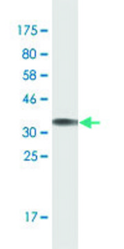 Monoclonal Anti-TIMM8B, (N-terminal) antibody produced