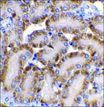 Anti-CAD antibody produced in rabbit
