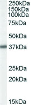 Anti-Bisphosphate 3?-nucleotidase antibody produced in