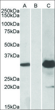 Anti-KCTD11 antibody produced in goat