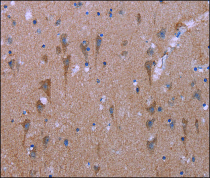 Anti-KCNJ9 antibody produced in rabbit