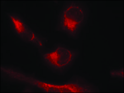 Anti-phospho-MAPT (pSer³??) antibody produced in