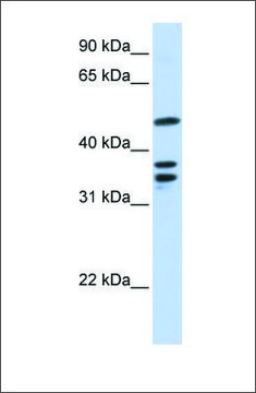 Anti-ETV6 (ab1) antibody produced in