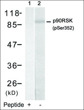 Anti-phospho-RPS6KA1 (pSer³?²) antibody produced in