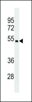 ANTI-CHST5(C-TERMINAL) antibody produced in rabbit