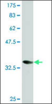 Monoclonal Anti-CORO1A, (C-terminal) antibody produced